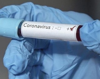 Оперативный штаб в КБР обновил данные по распространению коронавируса в КБР